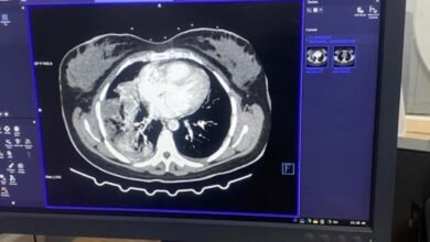 قطاع الأشعة بمستشفيات الشرقية
